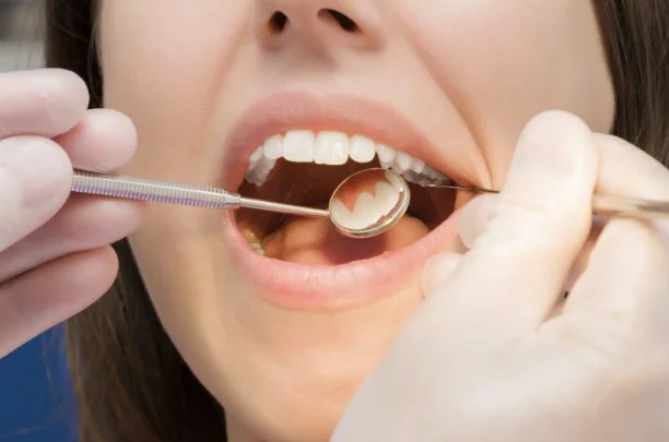 Why Regular Dental Checkups Are Essential for Long-Term Oral Health