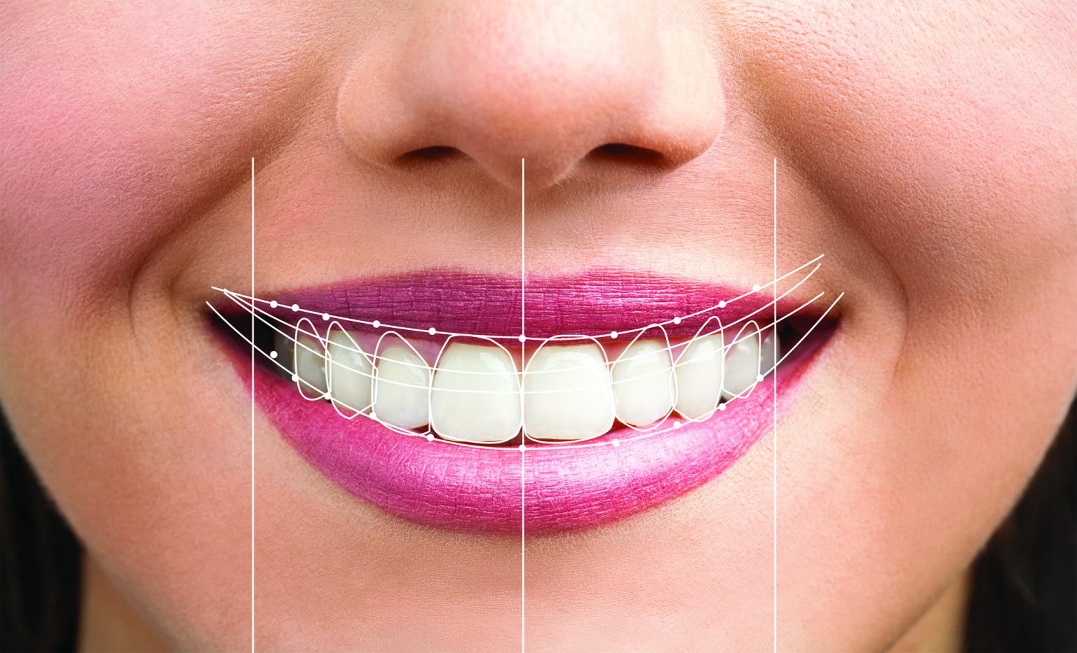 How a Smile Makeover Boosts Confidence & Career Success